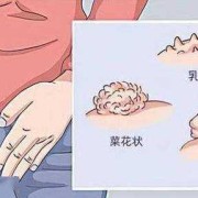 请问我怀孕时患有尖锐湿疣，顺产了宝宝，宝宝会被传染吗,