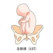 孩子睡觉背对着妈妈有什么说法吗,胎儿背对妈妈是什么胎位