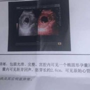 孕9周如何判断胎儿正常，要做什么检查,怎么判断胎儿是否正常发育