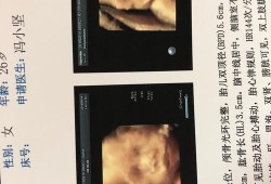 长鼻子男孩短片解析,胎儿三维鼻子好大
