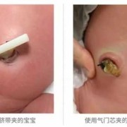 胎儿出生后脐带怎么办（胎儿出生后脐带怎么处理）