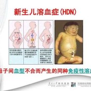 胎儿融血（abo溶血对胎儿发育有影响吗）