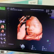 怀孕29周男孩胎儿图（双胞胎29周一般多少斤）