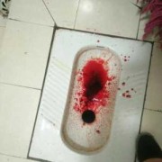 孕期大出血（孕期大出血是什么原因造成的）