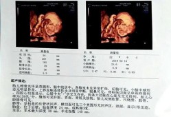 孕期检查数据（四维彩超hc是什么意思呢？是看什么的呢）