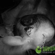 辐射会导致胎儿畸形吗（手机辐射会导致胎儿畸形吗）