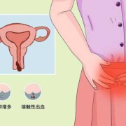 怀孕后宫颈息肉出血怎么办,孕期宫颈息肉反复出血怎么办