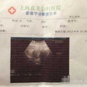 胎儿b超腿短（胎儿b超腿短怎么办）