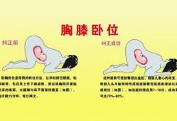 怀七个月的头位图怎么做,纠正胎儿头朝下姿势图片大全