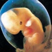 怀孕三十五周胎儿多重呢？一般情况下胎二多大合适,怀孕六个月胎儿多重正常