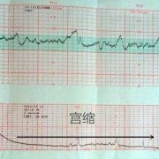 胎儿胎心快是什么原因造成的啊？孕八个月多了，要做什么检查好,胎儿胎心快是怎么回事