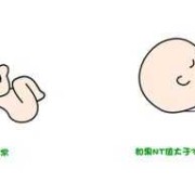 胎儿系统筛查是什么（it检查是什么意思啊）