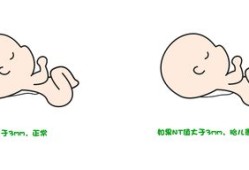 胎儿系统筛查是什么（it检查是什么意思啊）