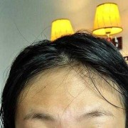 怀孕脸色发黄是什么原因,孕期脸色发黄怎么办呢