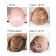 胎儿头部偏大（胎宝宝头偏大一周，怎么办）