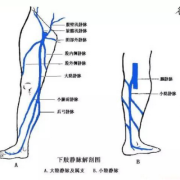 孕期外阴部静脉曲张图