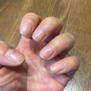 胎儿指甲划（胎儿指甲划子宫）