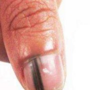4个月的宝宝指甲有竖纹怎么回事,怀孕4个半月胎儿在小腹下面