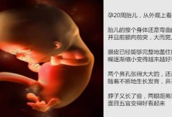 20周胎儿在肚子里图片（20周胎儿在肚子里干嘛）