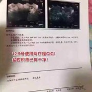 孕期盆腔积液怎么办（孕期盆腔积液怎么办,还有炎症怎么治疗）