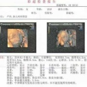 胎儿彩超CM（胎儿彩超cm是什么意思）