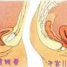 生完孩子宫颈下垂了应该怎么办,孕期宫颈下垂怎么改善