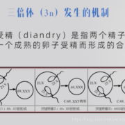 69三倍体胎儿（69三倍体胎儿XXY）