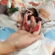 24周胎儿早产能存活吗（24周胎儿早产能存活吗多久）