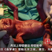 29周胎儿早产（29周胎儿早产存活率）