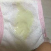 羊水是氧气水吗,胎儿洋水破了多久能生