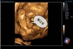 孕妇四维彩超什么时候做最好,13周胎儿四维彩超图看性别