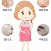 孕期色素沉着多久恢复（孕期色素沉着多久恢复正常）