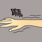 孕妇手指头麻是怎么回事,孕期手麻是怎么回事呢
