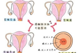 阴道炎会引起出血吗,孕期下面出血但不疼什么情况