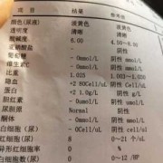 怀孕晚期尿潜血是怎么回事,孕期尿检潜血1+是什么意思