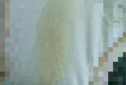 孕期白带发黄是怎么回事（怀孕期间孕妇内裤发黄是怎么回事）