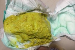 胎儿不排便（新生儿12小时没有大便这种情况正常的吗）