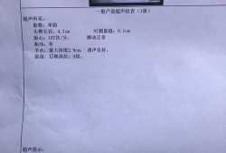 孕期nt检查时间（一般怀孕多久要做nt检查呢？需要多久时间）