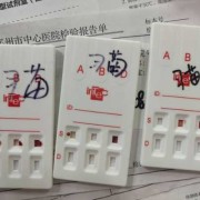 孕期rh血型阳性（血型鉴定阳性是什么）