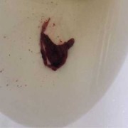 生化胎儿（生化胎儿）
