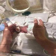 人类孕期（世界上最小怀孕年龄）