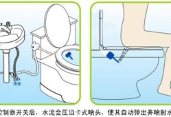 孕期肛门痒（怀孕6个月，肛门瘙痒疼痛怎么回事）