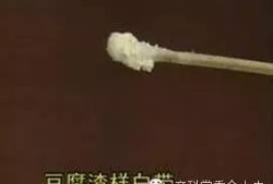 孕期分泌物增多是男孩（孕期分泌物增多是男孩）