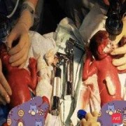 79天婴儿发育标准,怀孕79天的胎儿图片