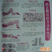 32周胎儿绕颈一周怎么办（32周胎儿绕颈一周怎么办好）