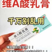 孕期能用药膏吗（孕期能用药膏吗女性）