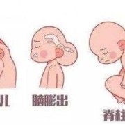 叶酸过多，会导致胎儿癫痫吗,胎儿羊癫疯的胎动特征