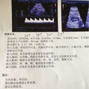 胎儿脚偏短（胎儿脚偏短是怎么回事?）