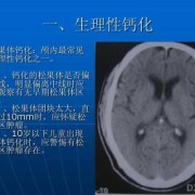 胎儿脑钙化（胎儿脑钙化是什么意思）