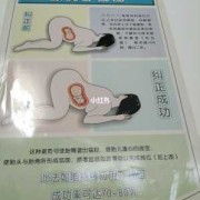 臂位胎儿怎样睡好（臂位胎儿怎样睡好）
